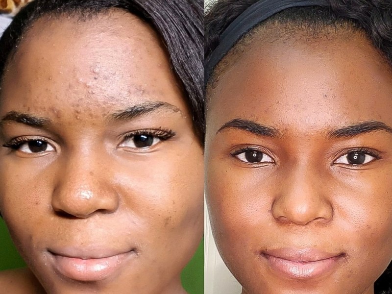 7 Skincare tips that saved my&nbsp;skin